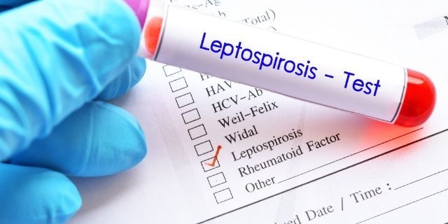 diagnóstico de leptospirosis