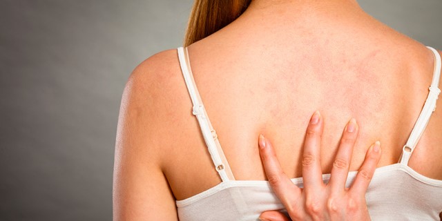 dermatilomanía en la piel